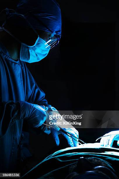 surgeon looking down, working, and holding surgical equipment with patient lying on the operating table - peking opera - fotografias e filmes do acervo