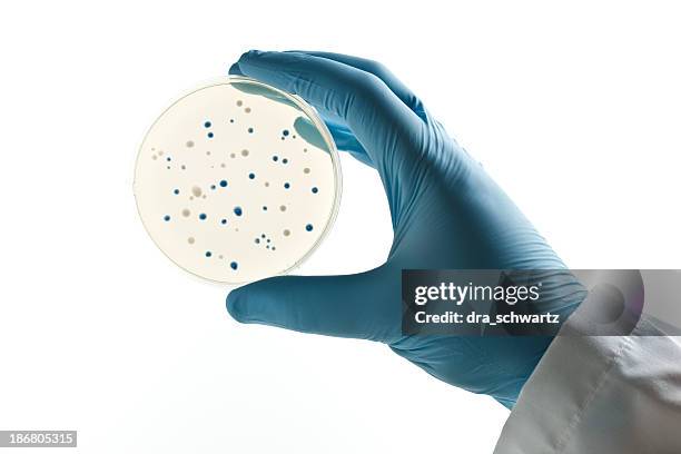 scientifique en tenant une boîte de pétri et bactérienne clones - boîte de pétri photos et images de collection