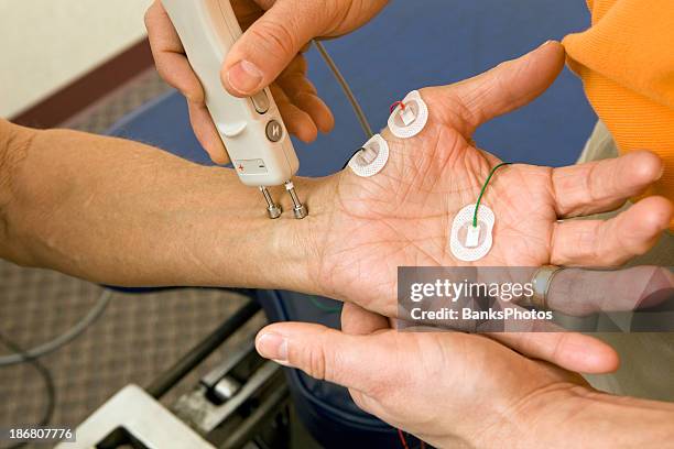 chiropractor performing a median ncv (nerve conduction velocity) test - electrode stock pictures, royalty-free photos & images