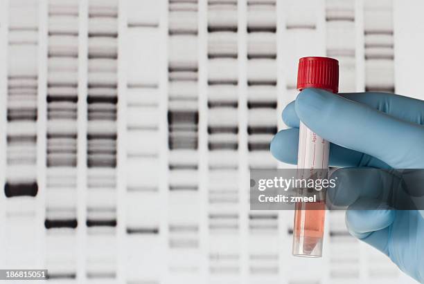 dna-test - dna test stock-fotos und bilder