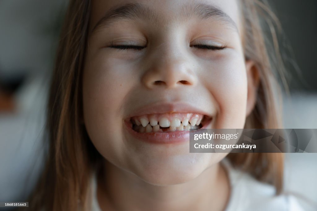 Girl Shows Off Missing Tooth High-Res Stock Photo - Getty Images