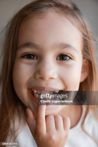 girl shows off missing tooth - kid missing teeth stock pictures, royalty-free photos & images