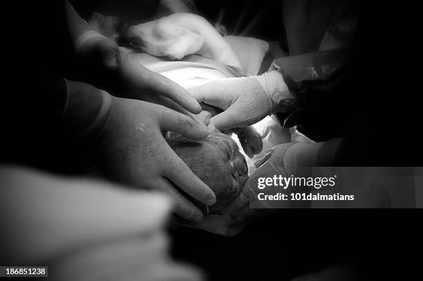 newborn baby welcome! - caesarean section stock pictures, royalty-free photos & images