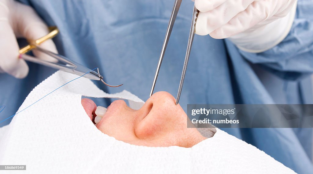 Procedimento cirúrgico