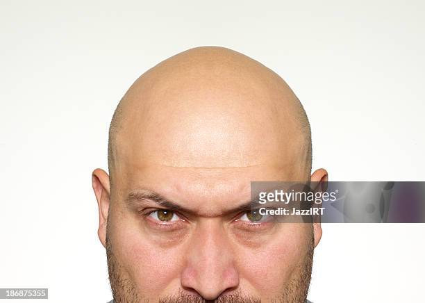 164 Ugly Bald People Photos and Premium High Res Pictures - Getty Images