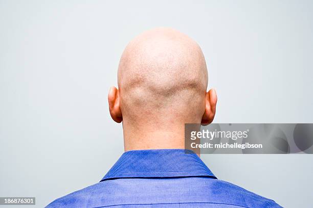 back of man ist bald head - haarausfall stock-fotos und bilder