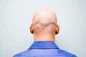 Back of man's bald head