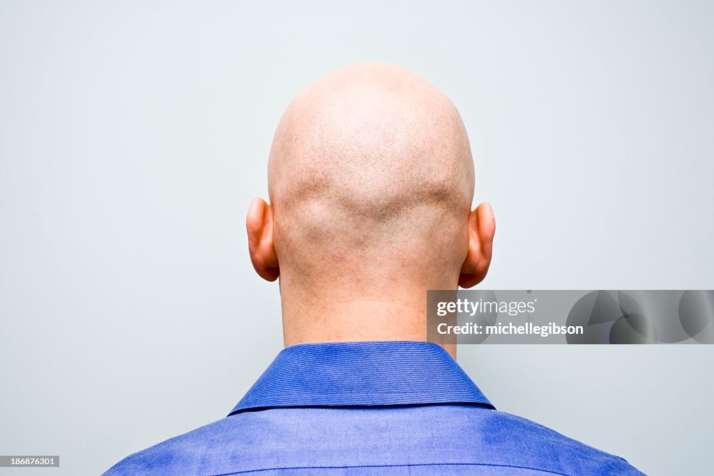 Back of man's bald head