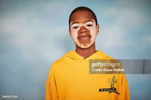 boy with vitiligo wearing yellow sweatshirt - african kids stylish stock pictures, royalty-free photos & images
