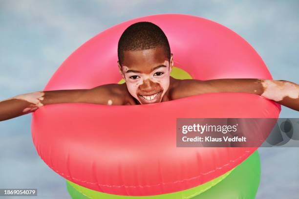 smiling boy with vitiligo wearing pink inflatable ring - face arms stock pictures, royalty-free photos & images