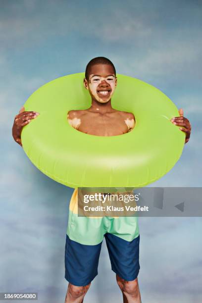 boy with vitiligo holding green inflatable ring - recreational equipment stock pictures, royalty-free photos & images