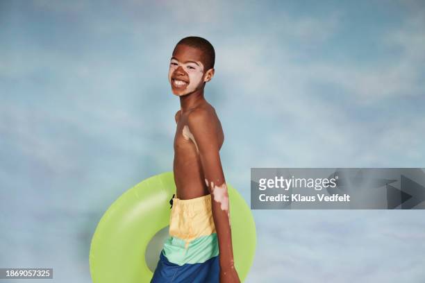 boy with vitiligo carrying green inflatable swim ring - recreational equipment stock pictures, royalty-free photos & images
