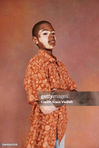 confident vitiligo boy standing with arms crossed - budding tween stock pictures, royalty-free photos & images