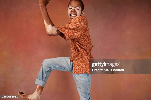 cheerful boy with vitiligo dancing in floral shirt - barefoot male stock pictures, royalty-free photos & images