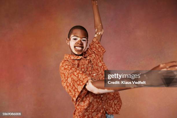 happy boy with vitiligo dancing in floral shirt - african kids stylish stock pictures, royalty-free photos & images