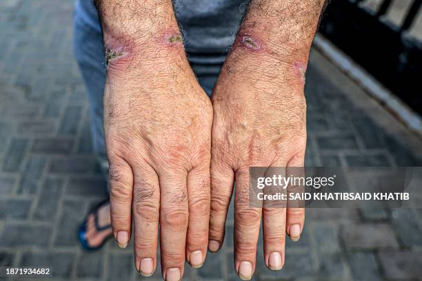 Graphic content / A man, who was detained with other Palestinians by the Israeli military during their operation in the northern Gaza Strip and...