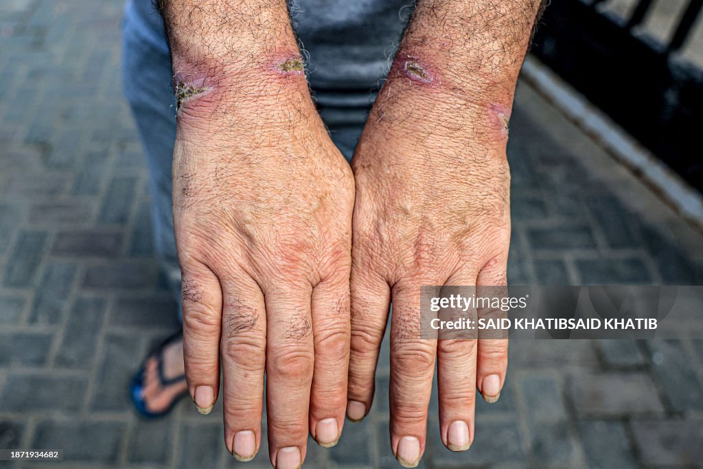 PALESTINIAN-ISRAEL-CONFLICT-DETAINEES