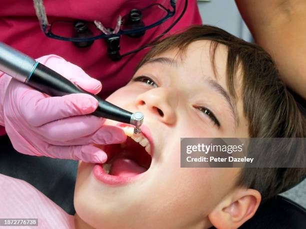 cleaning boy's teeth - a male dentist stock pictures, royalty-free photos & images