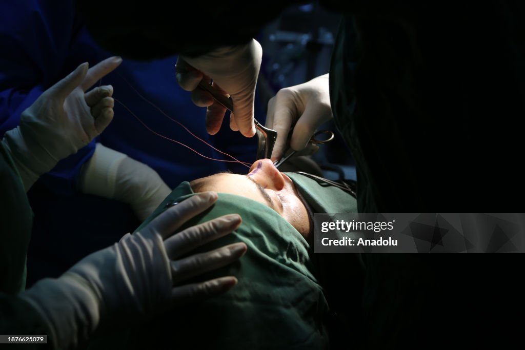 Increasing number of plastic surgeries in Iran