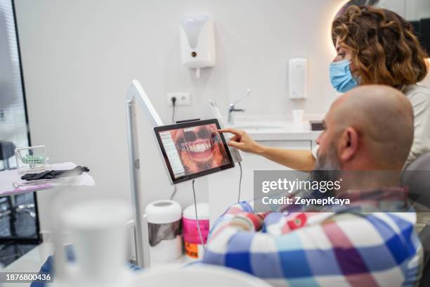 dentist examining dental images on monitor of patient in the clinic. - implante dentário imagens e fotografias de stock