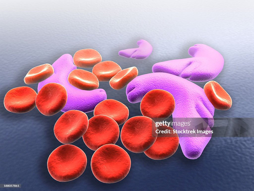 Conceptual image of sickle cell anemia.
