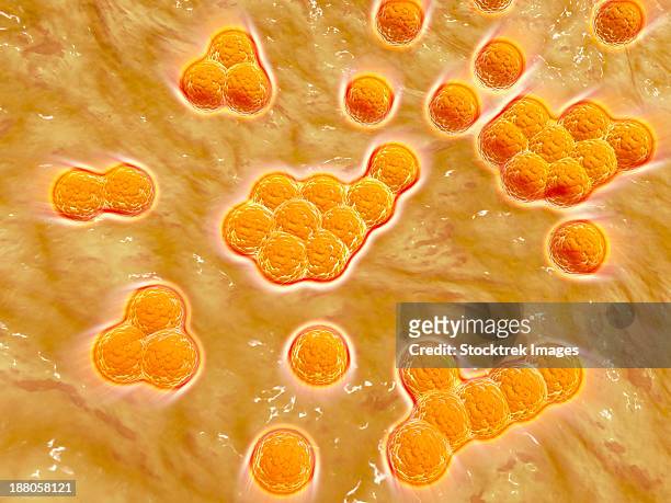 microscopic view of methicillin-resistant staphylococcus aureus (mrsa). - hospital acquired infection stock illustrations