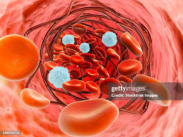 microscopic view of blood flow inside an artery with stent deployment. - stent stock illustrations