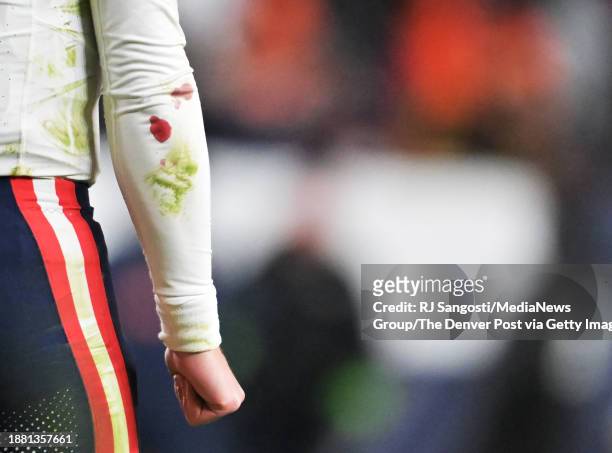 New England Patriots quarterback Bailey Zappe has blood on his arm during the second half of the game at Empower Field at Mile High in Denver,...