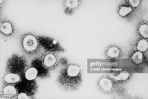 This undated handout photo from the Centers for Disease Control and Prevention shows a microscopic view of the Coronavirus at the CDC in Atlanta,...