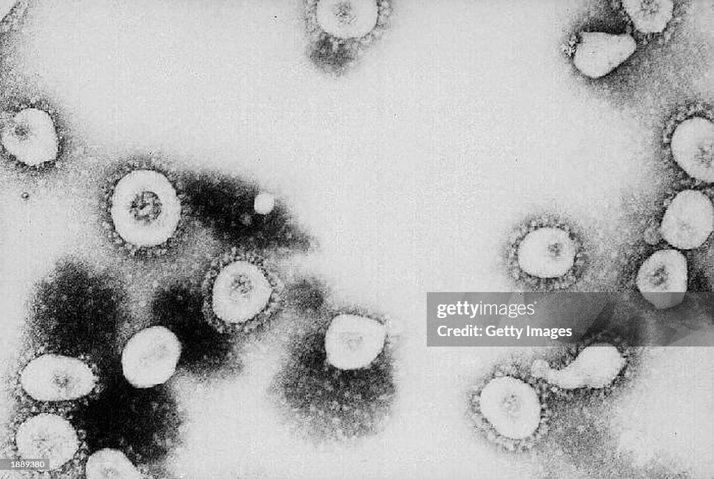 CDC Says SARS Might Be A Form Of The Coronavirus