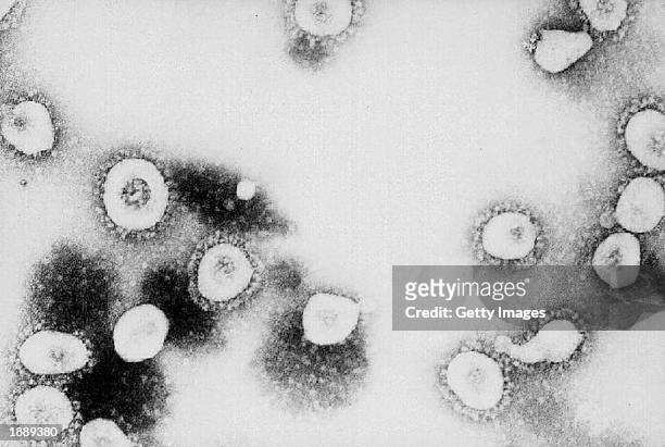 This undated handout photo from the Centers for Disease Control and Prevention shows a microscopic view of the Coronavirus at the CDC in Atlanta,...