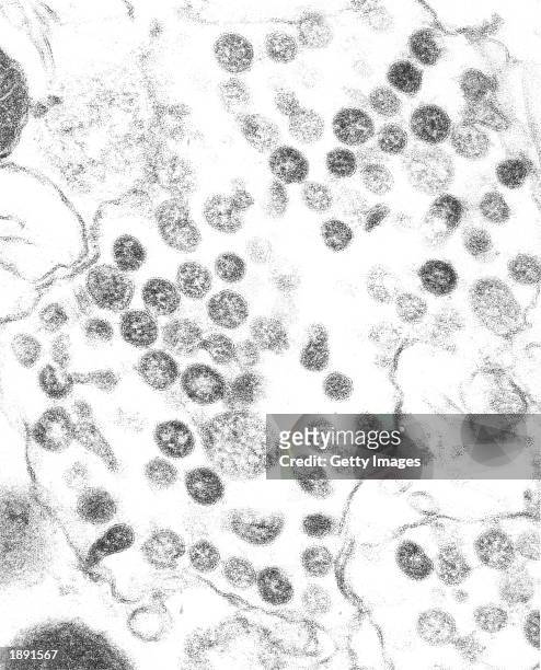 This handout image from the Centers for Disease Control and Prevention shows a thin section-high magnification view of a Coronavirus isolate possibly...