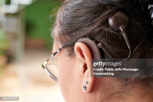 2,367 Cochlear Implant Images Stock Photos, High-Res Pictures, and ...