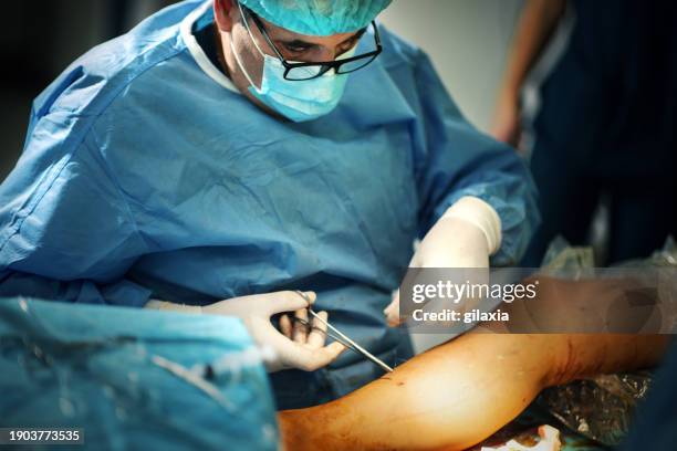 lower limbs surgical procedure. - blodpropp bildbanksfoton och bilder