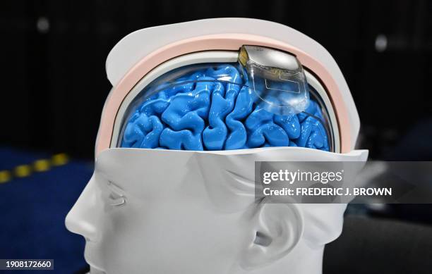 The Wimagine implant from CEA, a device seen on a replica brain which helps patients with spinal cord issues walk again is on display during the...