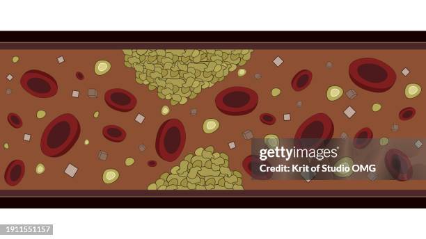 abstract images health problem fats on artery, blood pressure disease - clogged artery stock pictures, royalty-free photos & images