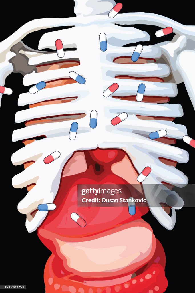 Rib Cage Ribs With Antibiotic Capsules High-Res Vector Graphic - Getty ...