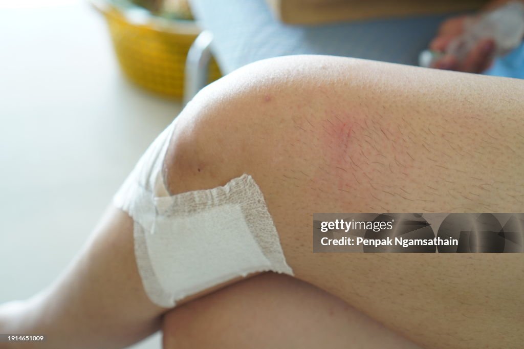 Knee bandages