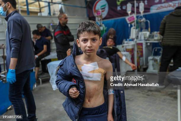 Young Palestinian injured in Israeli air strikes is treated at Kuwait Hospital on January 08, 2024 in Rafah, Gaza. Despite Israel's recent troop...
