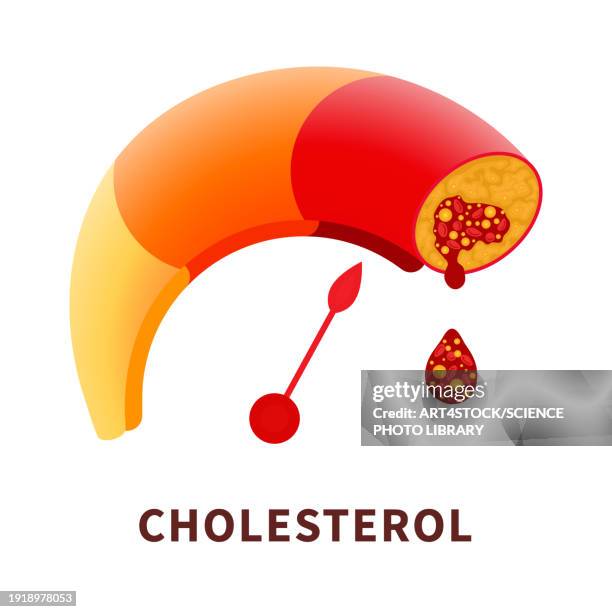 atherosclerosis, conceptual illustration - risk meter stock illustrations