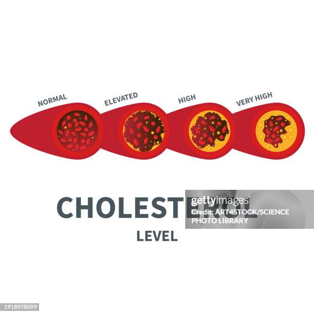 cholesterol, conceptual illustration - high density lipoprotein stock illustrations