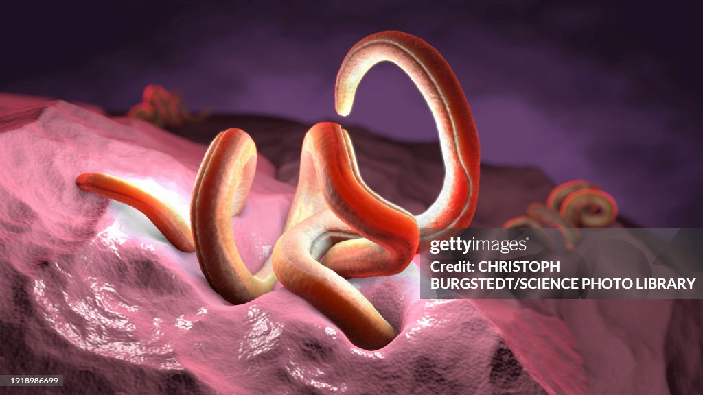 Dematode Nematode Inside Intestine Illustration High-Res Vector Graphic - Getty ...