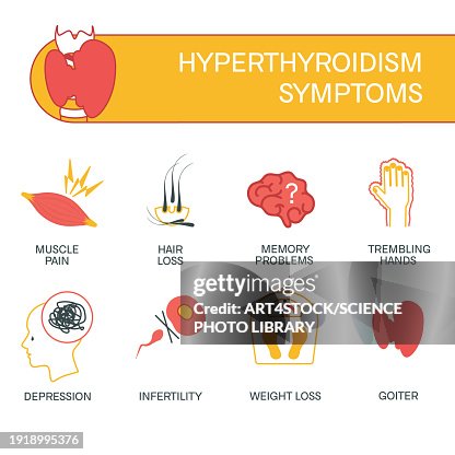 Hyperthyroid State Hyperthyroidism Conceptual Illustration High-Res Vector Graphic - Getty ...