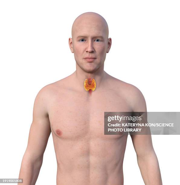 Normal Goiter 402 Goiter High Res Illustrations - Getty Images