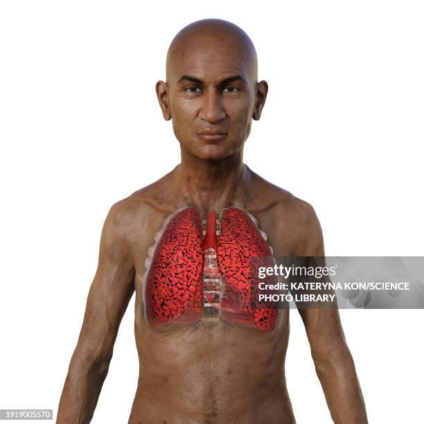 man with smoker's lungs, illustration - man 50 white background stock illustrations