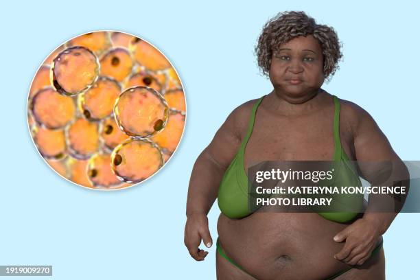 ilustraciones, imágenes clip art, dibujos animados e iconos de stock de overweight woman and adipocytes, illustration - tejido adiposo