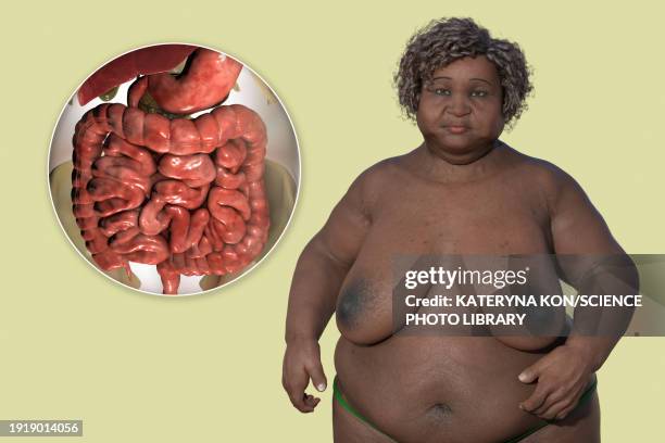 overweight woman and digestive system, illustration - woman intestine stock illustrations