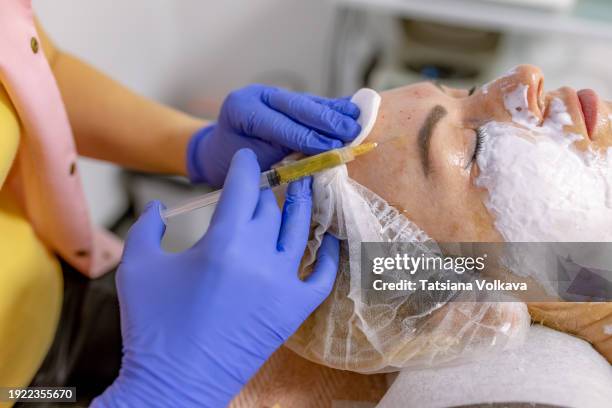 side view of middle-aged woman face lying down with eyes closed during plasma facelift procedure - face lift stock pictures, royalty-free photos & images