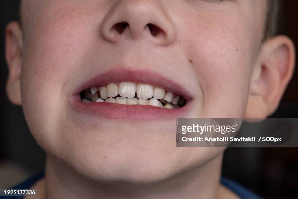 close-up of boy with gap toothed - ugly lips stock pictures, royalty-free photos & images