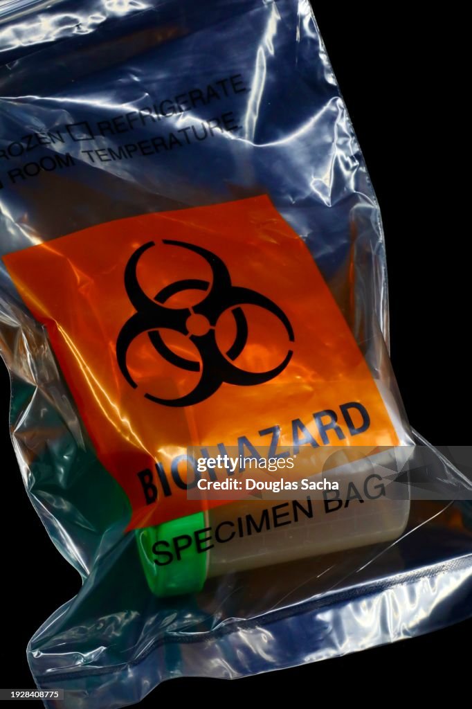 Specimen biohazard bag with bodily fluid sample